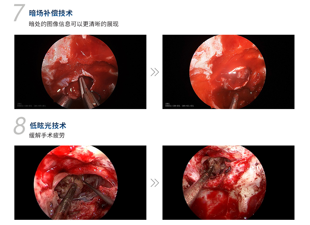 4K醫(yī)用內(nèi)窺鏡攝像系統(tǒng) YKD-9211